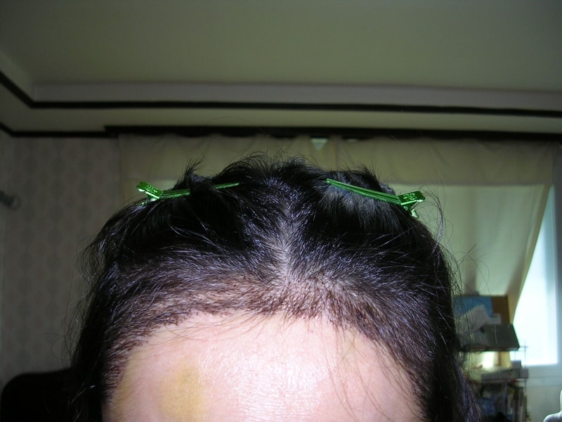 hair-1.JPG