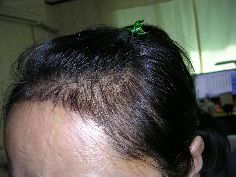 hair-3.JPG