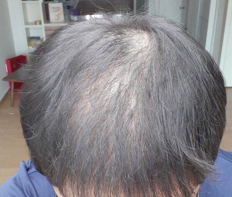 머리2.jpg