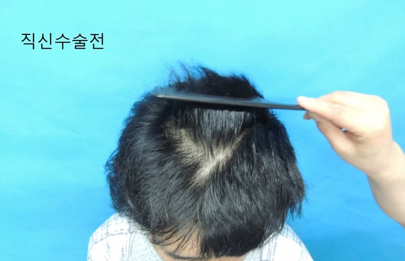 수술전 (2)2.jpg