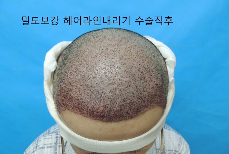수술당일 (2)2.jpg