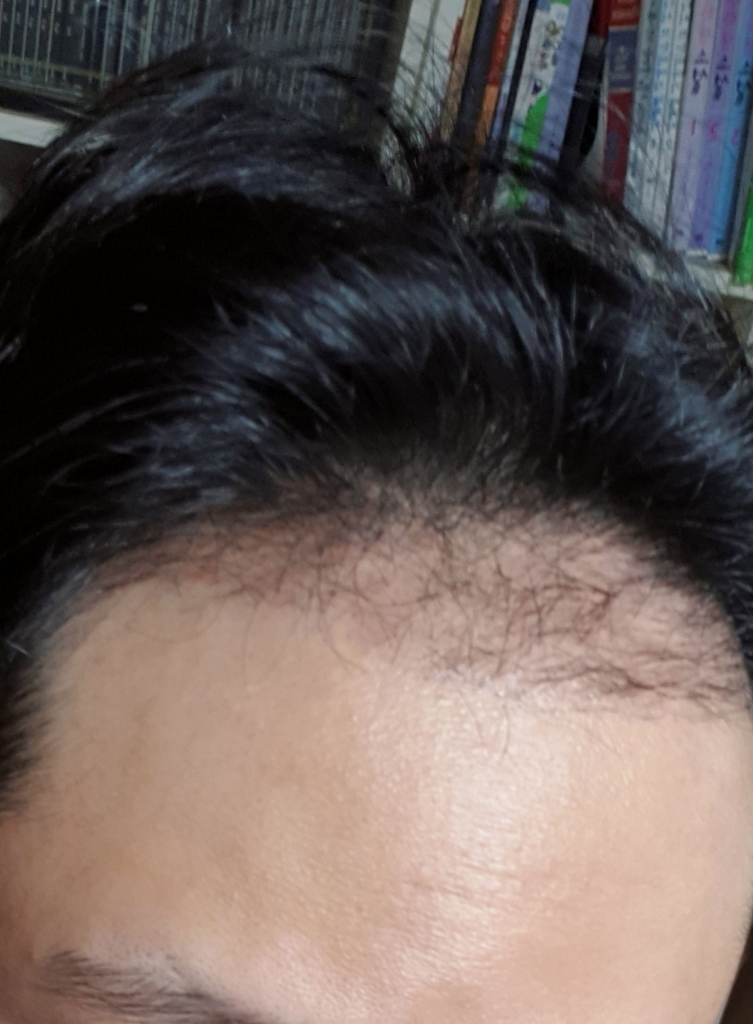 20190301_083630.jpg