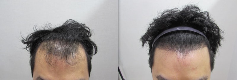 머리올림.jpg