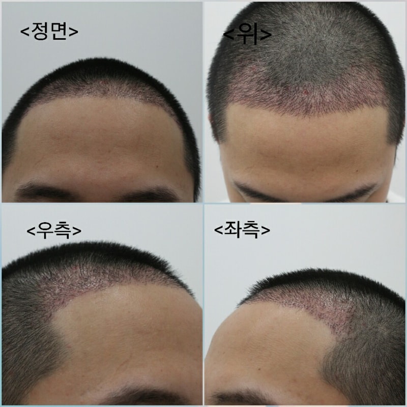 3주차 스케일링 후.jpg