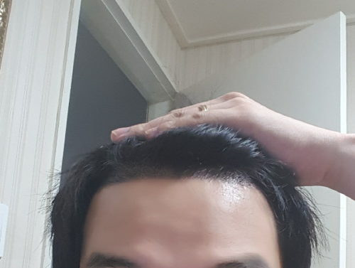 ㅇ.png