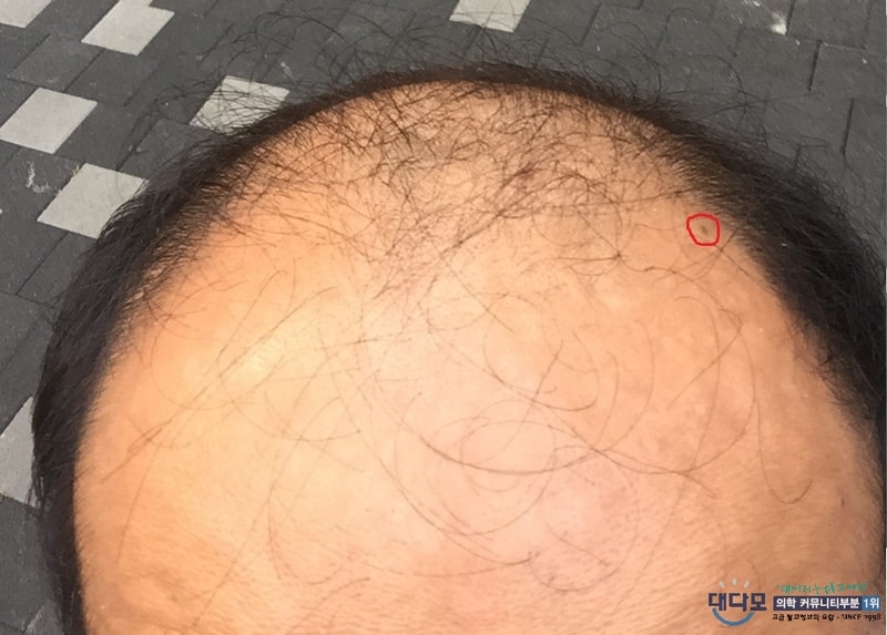 before.jpg