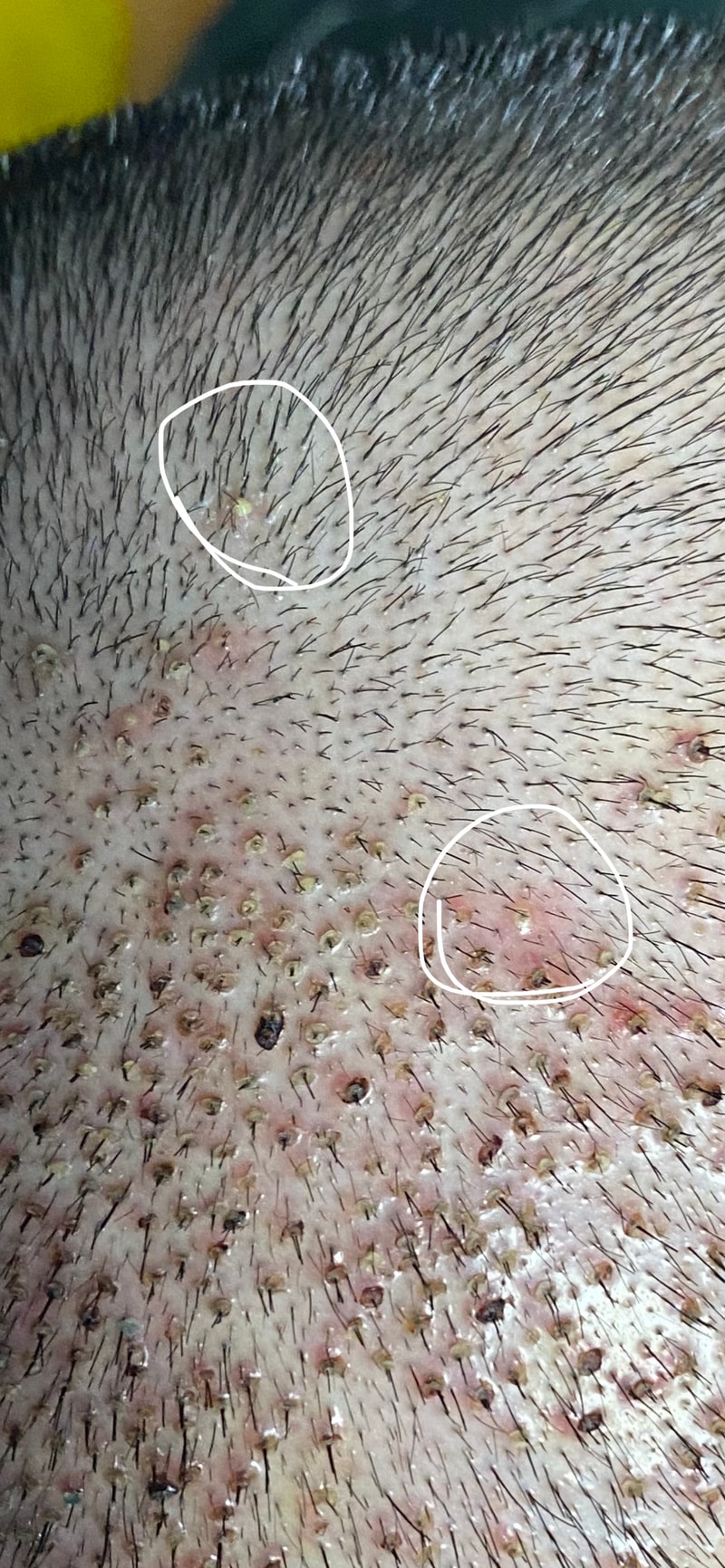 34090185-9CE5-434D-B4F2-16B3CE1EDF34.jpeg