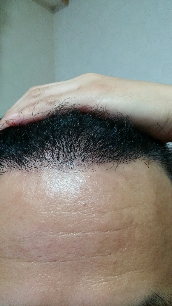 20151116_211847.jpg