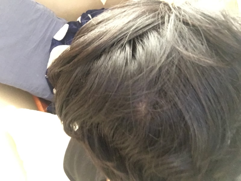 정수리1.JPG