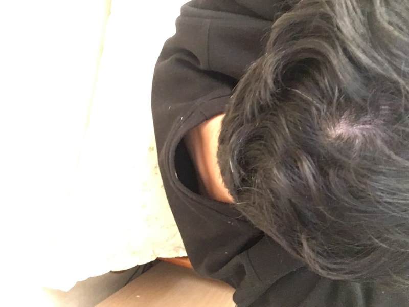 정수리2.JPG