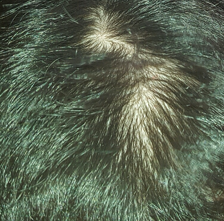 20170421_161701.jpg
