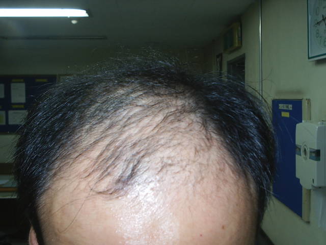 S2010001.JPG
