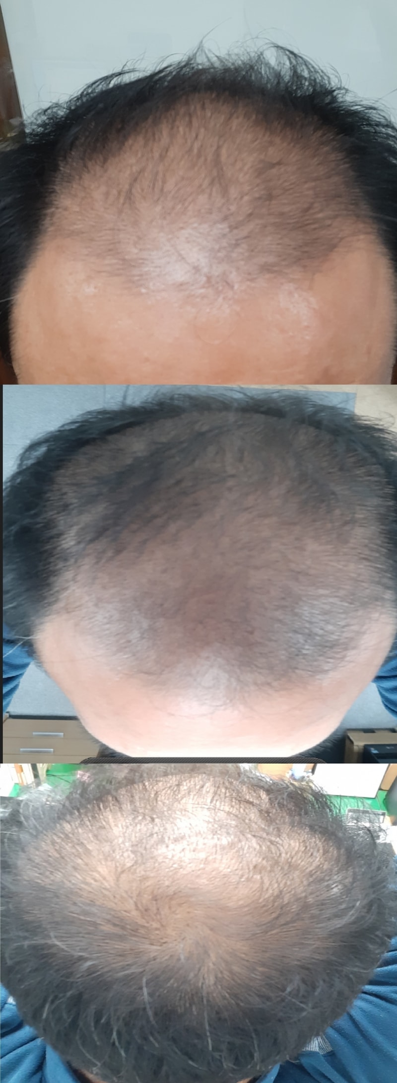 수술전약물복용전.jpg