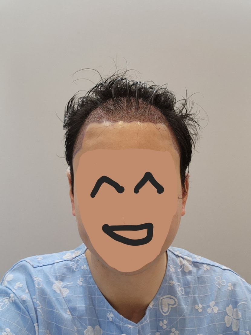 직후