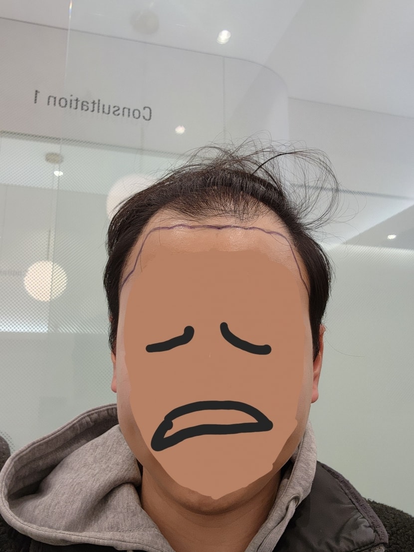 직전