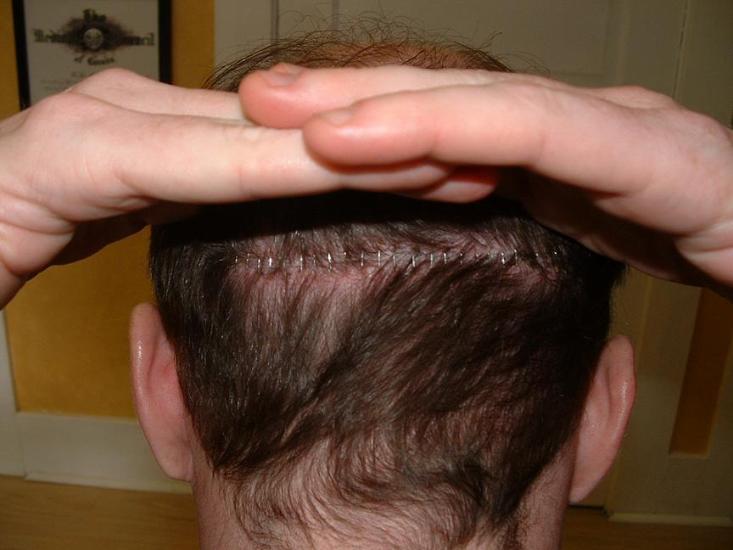 before removing.jpg