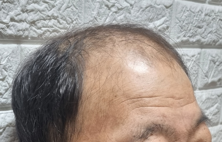 화면 캡처 2025-12-16 102821.png