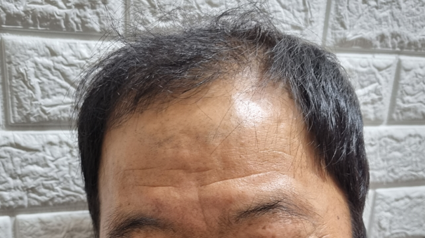 화면 캡처 2025-12-16 102841 후.png