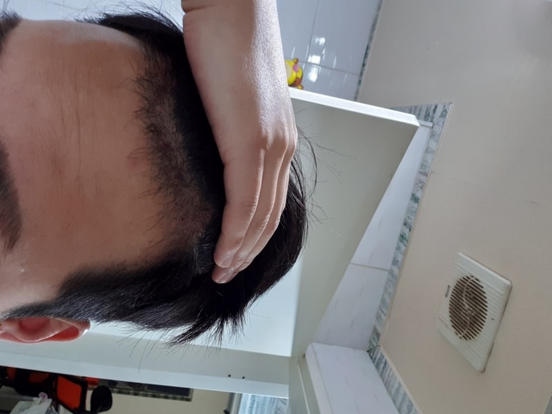 20190317_052533.jpg