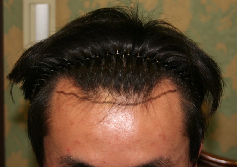before.jpg
