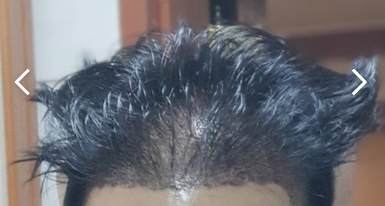 1.PNG
