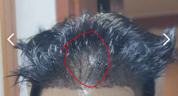2.PNG