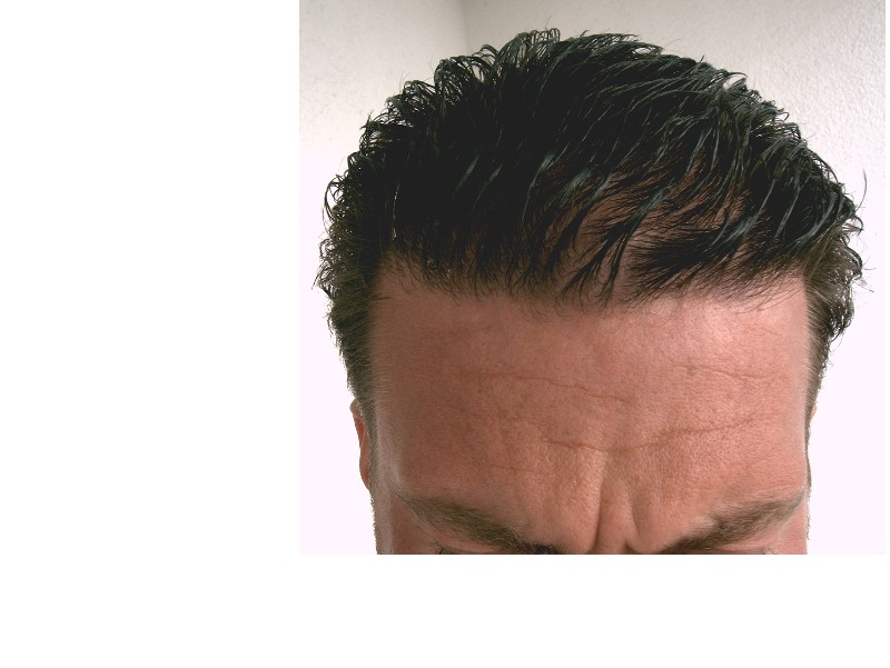 10monthsafterwethairsmallsize.jpg