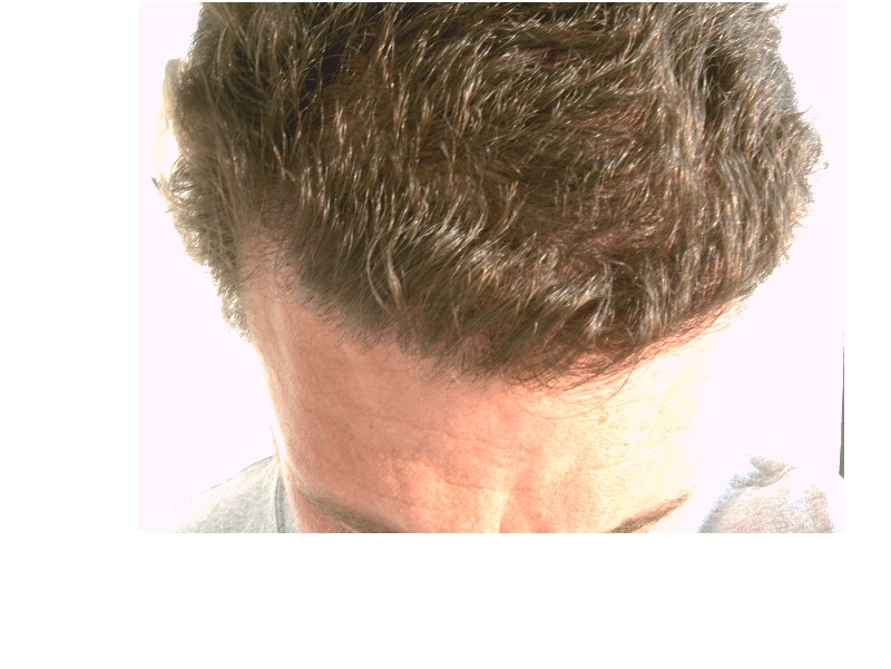 after.jpg