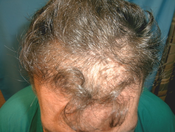 before.jpg