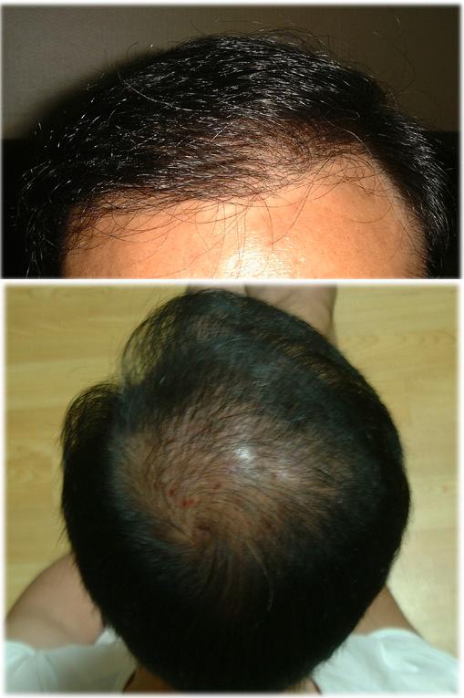 front-10month.JPG