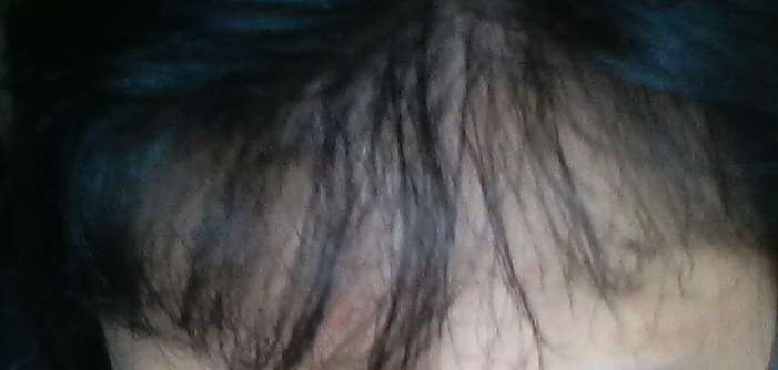 11.bmp
