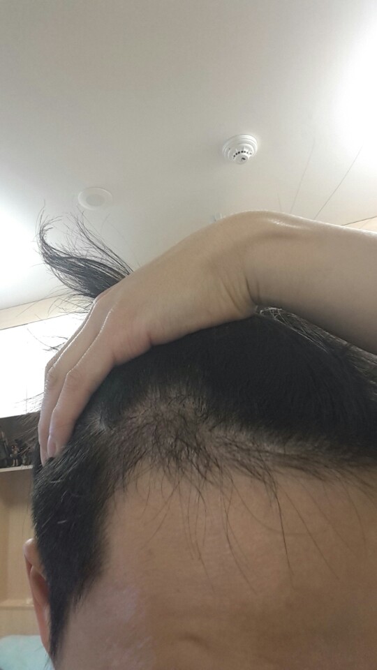 왼쪽2번.jpg