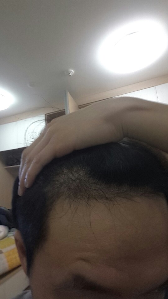 왼쪽1번.jpg