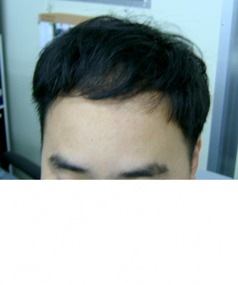 모자익.jpg