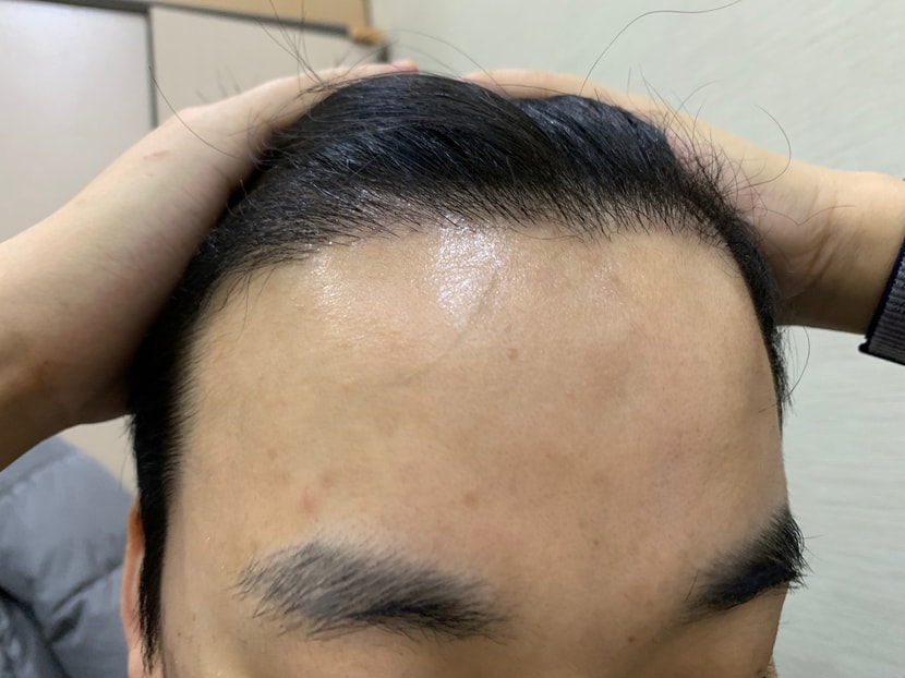 5달 