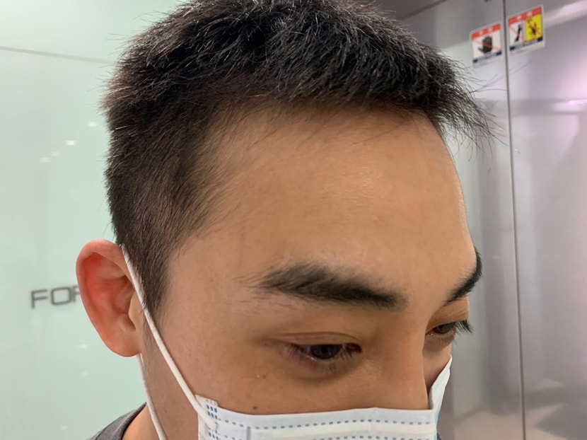 경과 3~4개월차