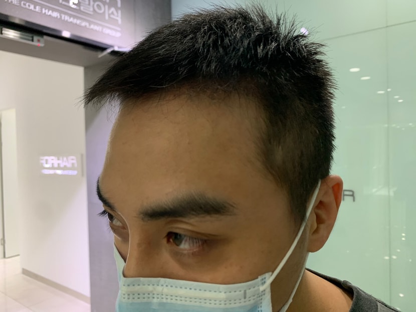 경과 3~4개월차