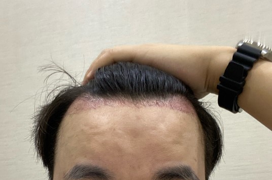 2달