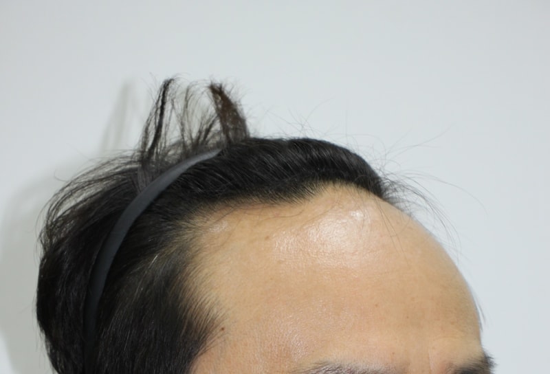 수술전.JPG