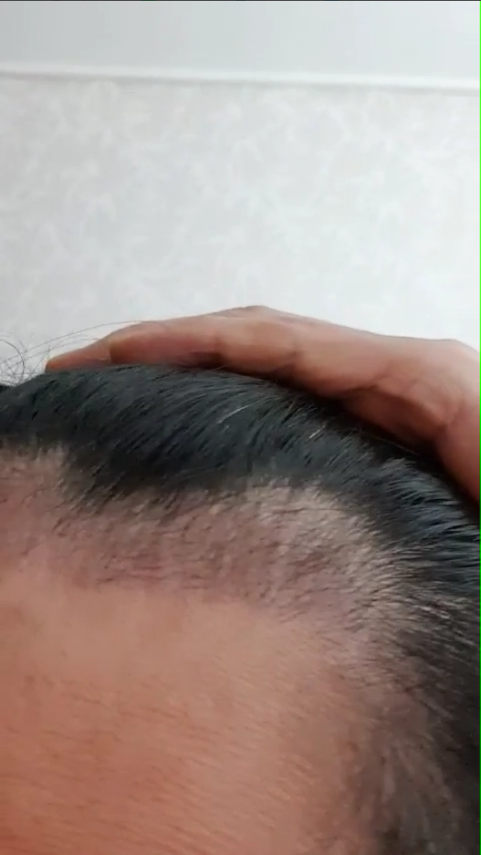 3개월.png