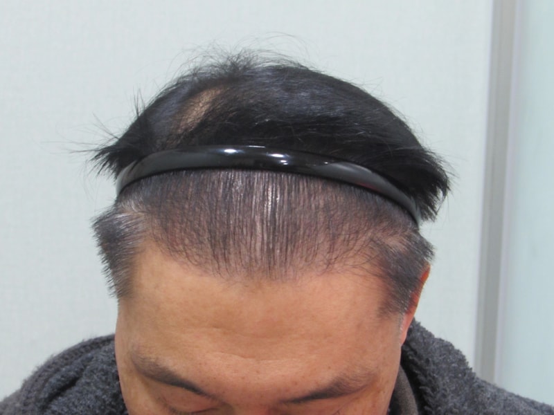 후1.jpg