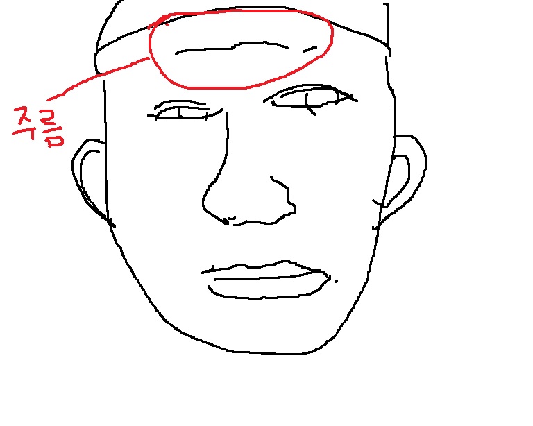마빡.jpg