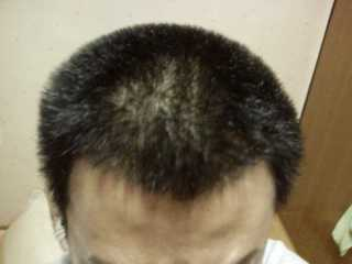 hair.bmp