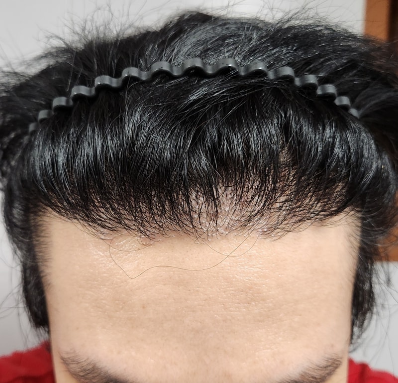 1000053915.jpg