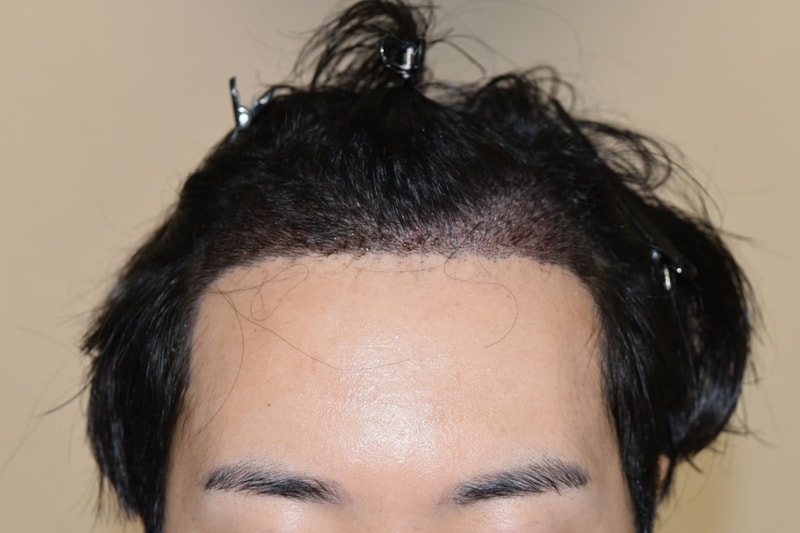 1000033926.jpg