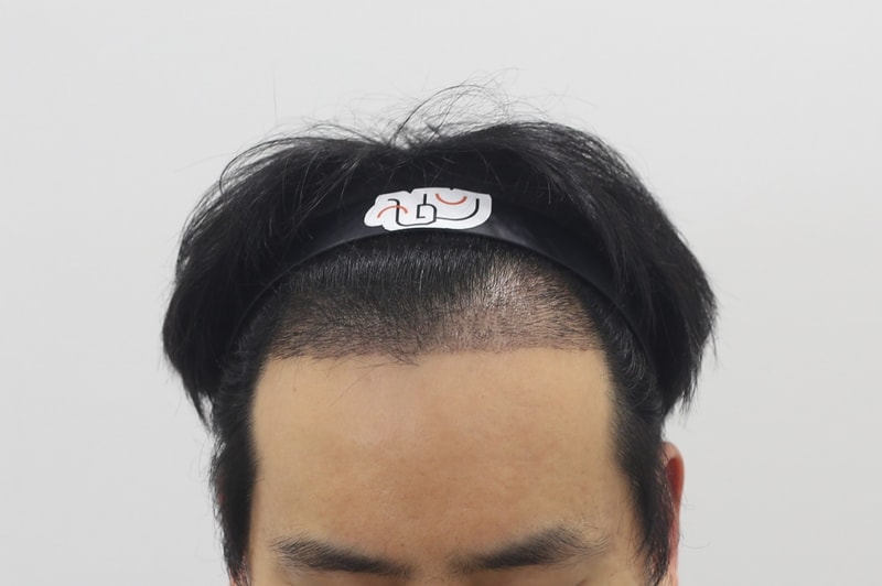 1000003044.jpg