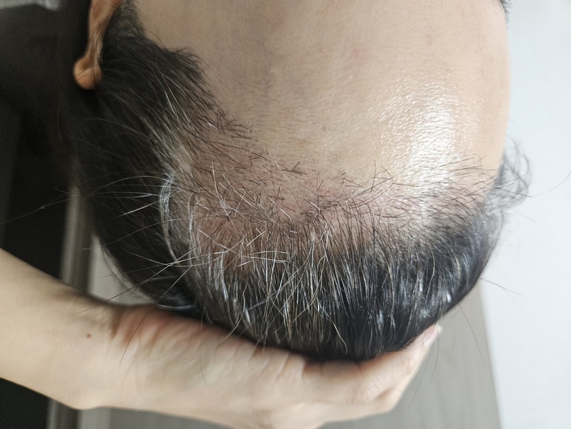 현재