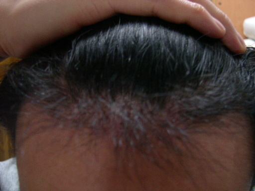 수술후3.JPG