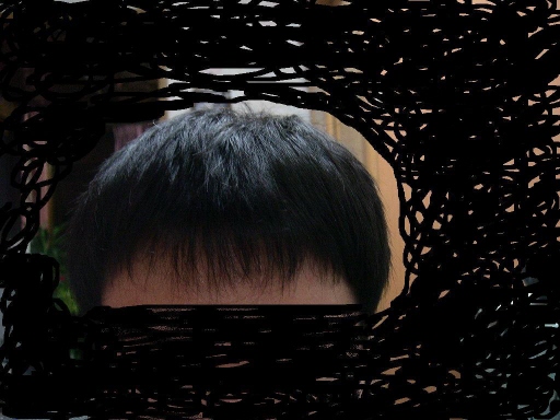 수술후1.JPG