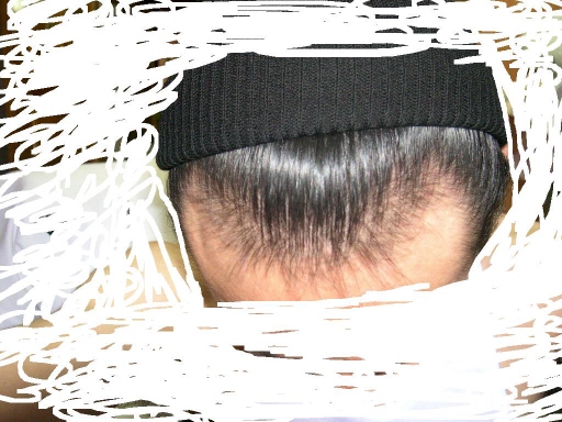 수술전2.JPG